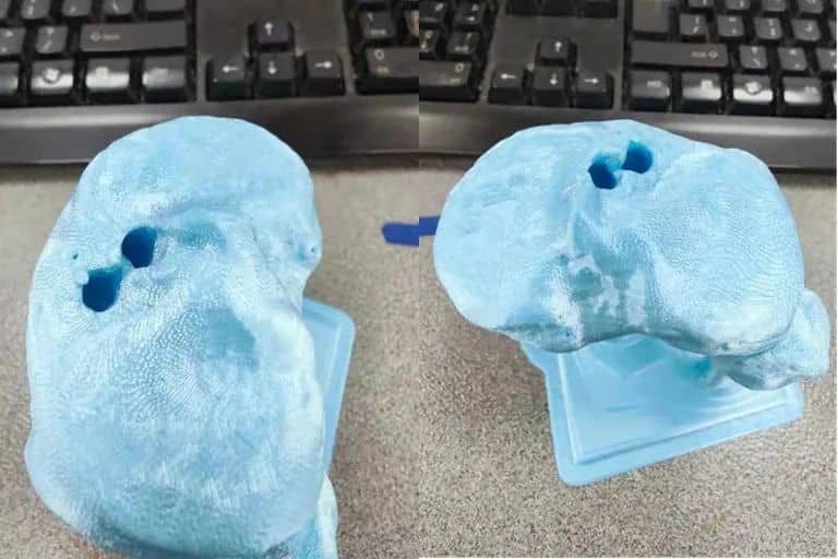 長沙市中醫(yī)院應用3D打印技術制作百余例模型，助力精準醫(yī)療